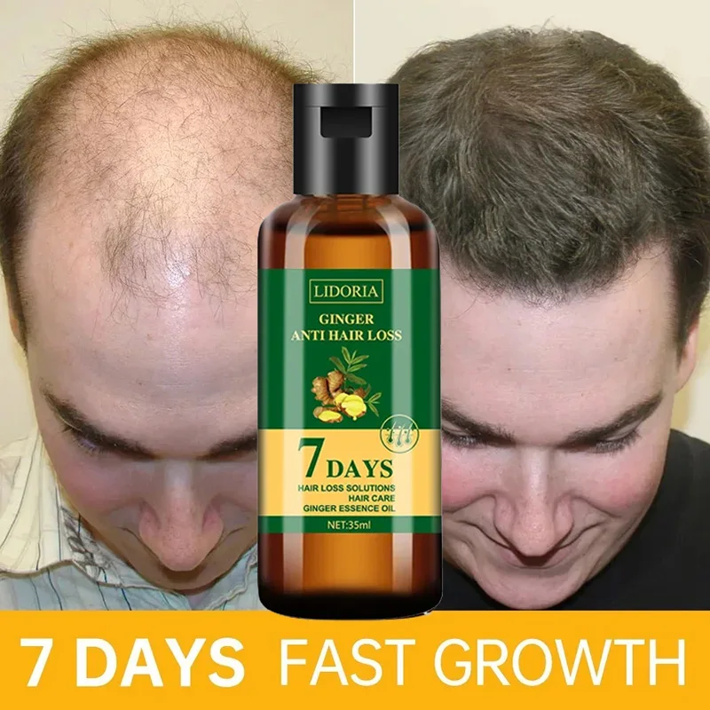 Hair Care Essential Oil Atomizing - Aceite Esencial de jengibre para el