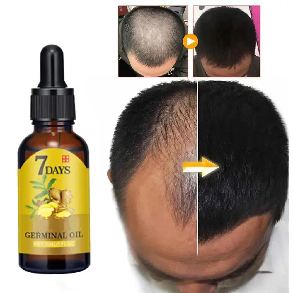 Hair Care Essential Oil Atomizing - Aceite esencial de jengibre para el
