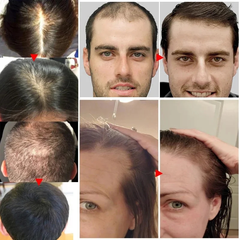 Aceite Esencial de jengibre pa - Hair Care Essential Oil Atomizing reseña y precio