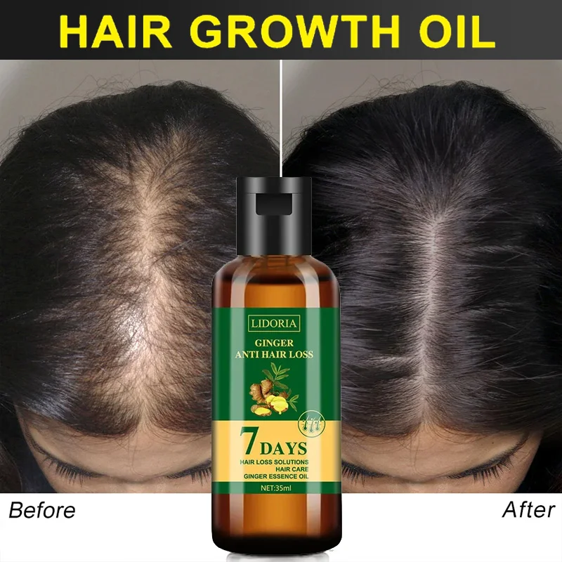Aceite Esencial de jengibre pa - Hair Care Essential Oil Atomizing reseña y precio