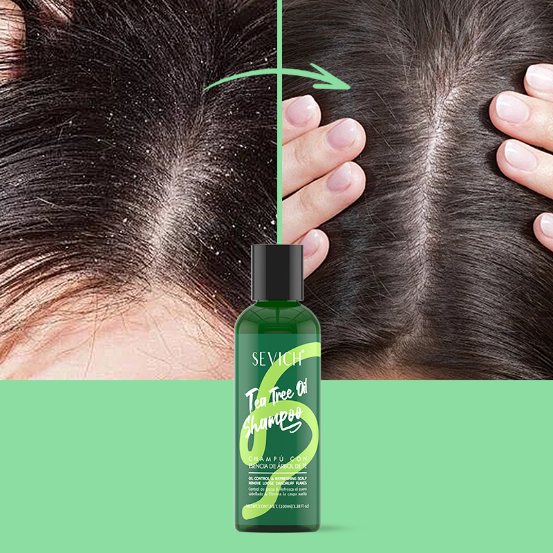 Champú con esencia de árbol de - Hair Care Set reseña y precio