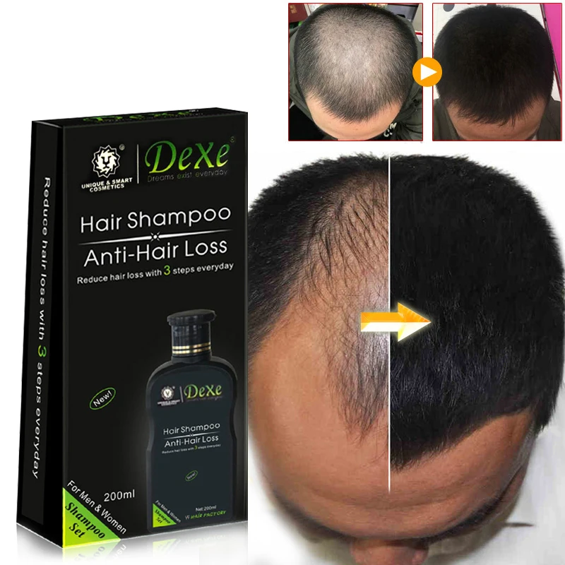 Champú profesional para el cre - Hair Care Herbal reseña y precio