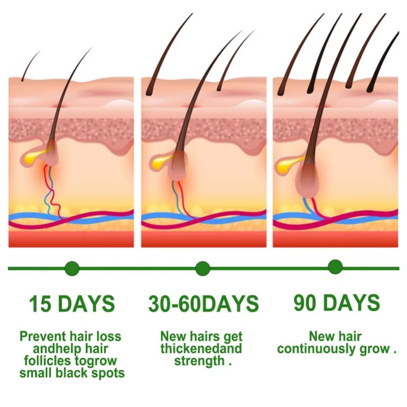 Suero para el crecimiento del  - Hair Care Essential Oil Atomizing reseña y precio