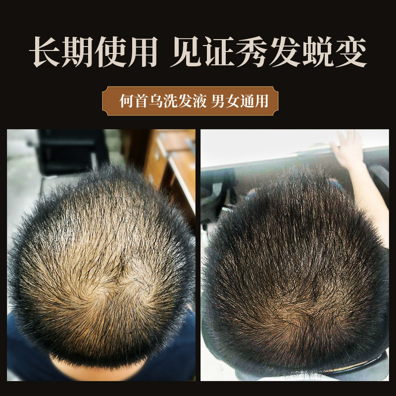 Champú poligonum multiflorum d - Hair Care Herbal reseña y precio