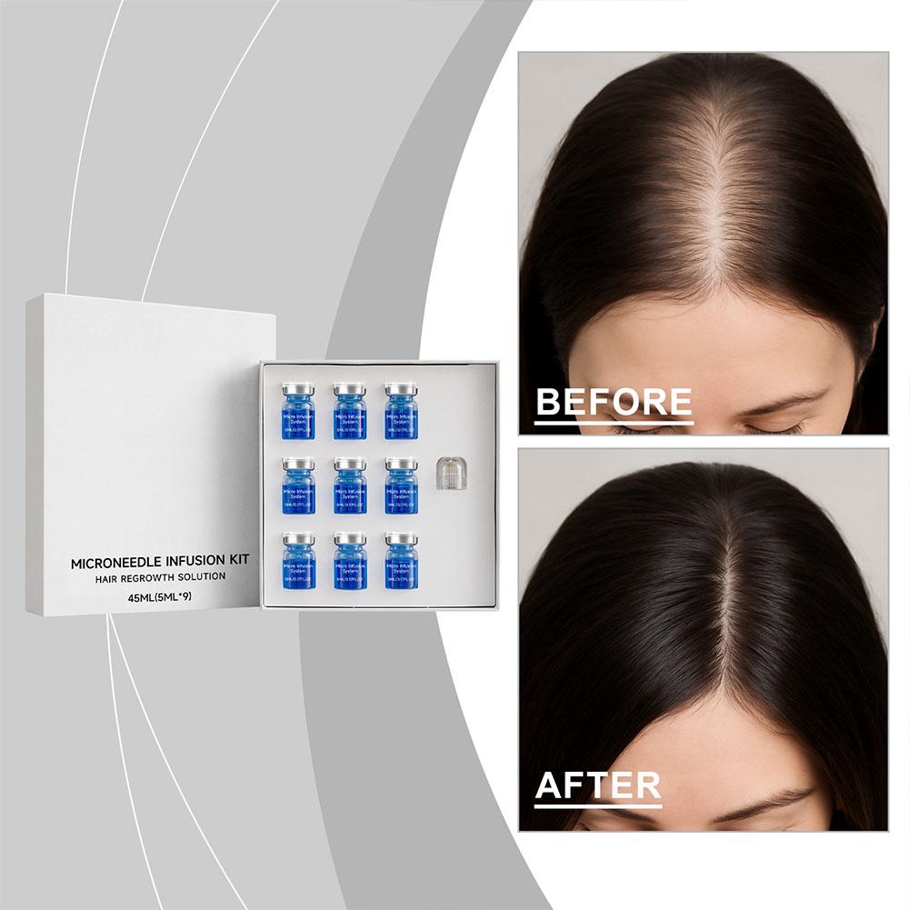 Set de Rodillo de Microagujas  - Hair Care Essence Oil reseña y precio