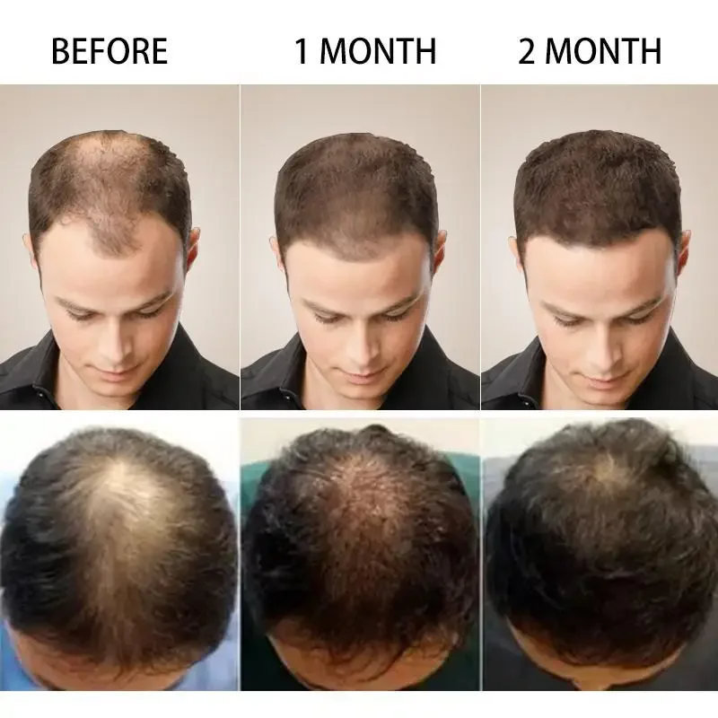 Aceite esencial de jengibre pa - Hair Care Essential Oil Atomizing reseña y precio