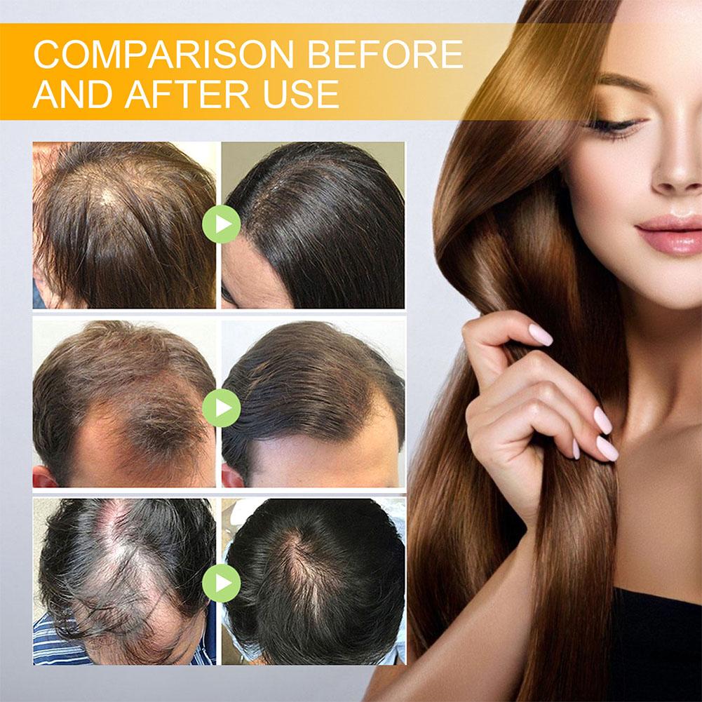 5/3/1 Uds biotina productos pa - Hair Care Herbal reseña y precio